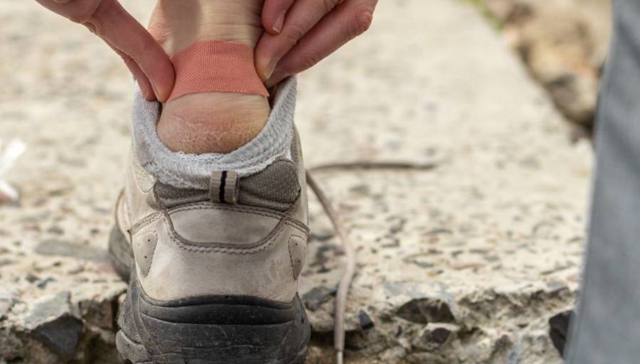 How to Prevent Blisters When Hiking - Essential Tips