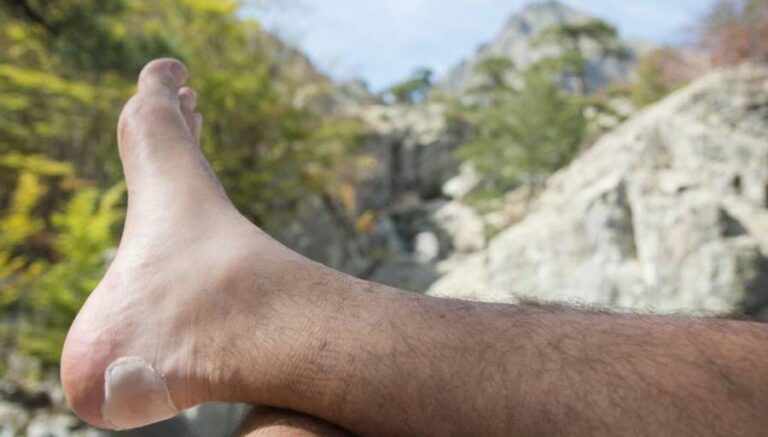 how-to-treat-foot-blisters-while-hiking-outdoor-shell